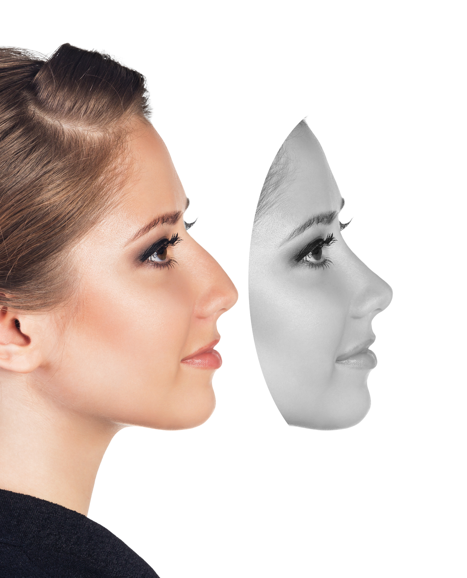 Kada je najbolja dob da se rinoplastika obavi?